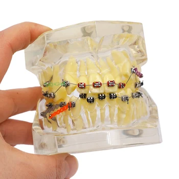 Дентално ортодонтско лечение Модел на зъбите Модел за корекция на малоклузия със скоби Верижна жица за изучаване на преподаването